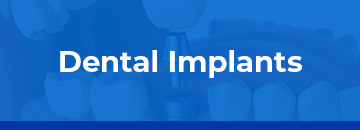 Dental Implants Sterling Heights MI